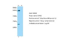 CARS2 Rabbit anti-Human, Polyclonal, Novus Biologicals 0.1ml; Unconjugated:Antibodies,